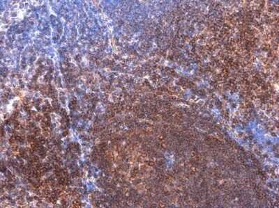 Immunohistochemistry-Paraffin: BTK [p Tyr223] Antibody [NBP3-12916]